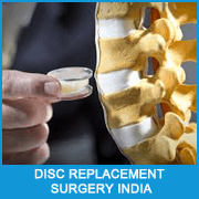 Total Disc Replacement surgery in India