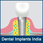 Best Dental Surgery Hospitals in Mumbai